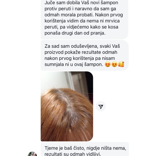noi Å¡amp