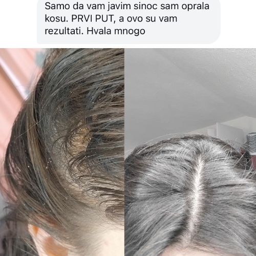 novii Å¡ampoo