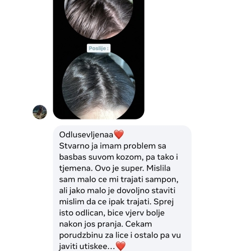 novi Å¡amponiÄ