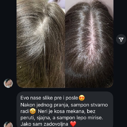 noviÄ Å¡amp